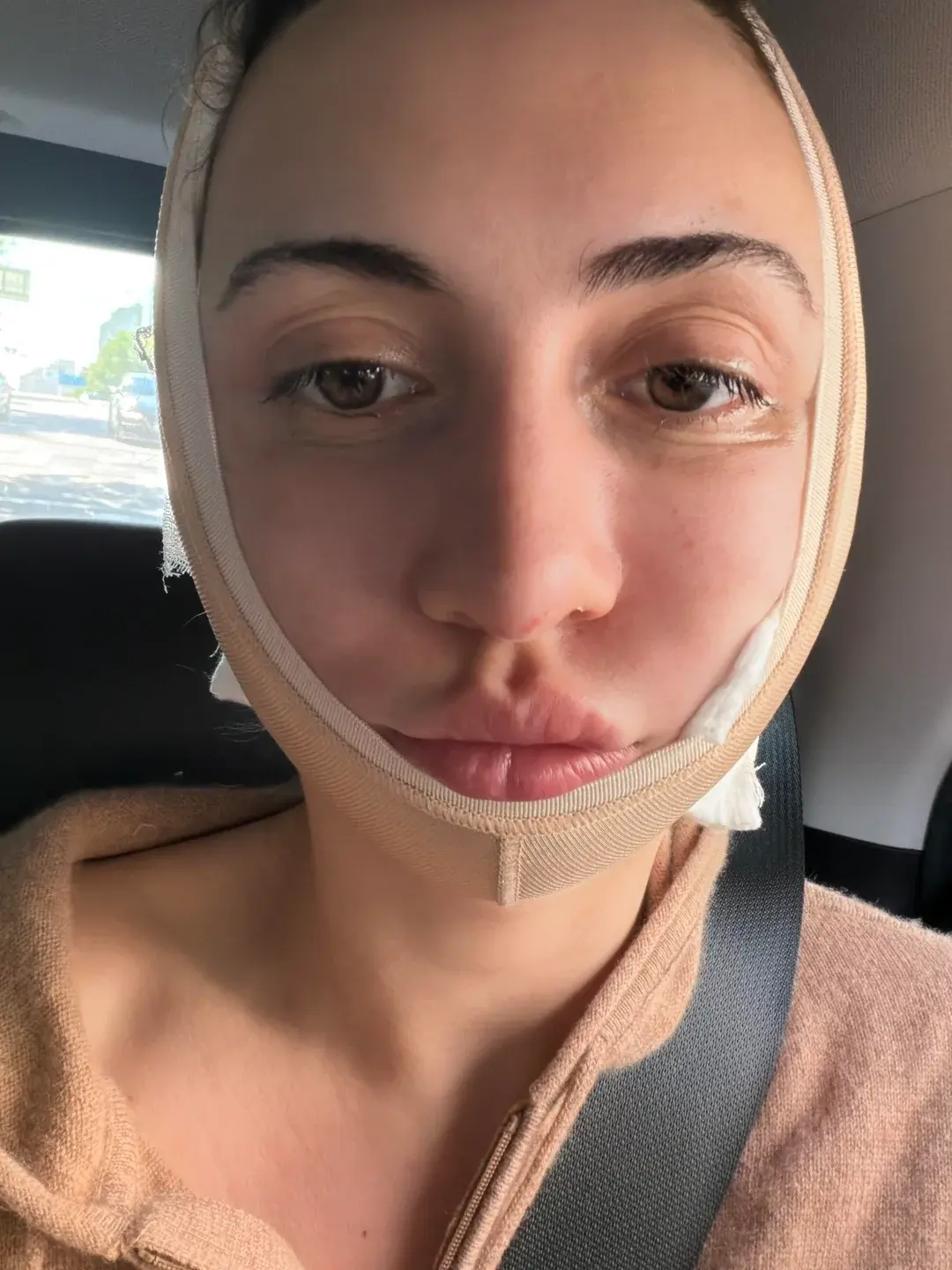THE Plastic Surgery — 1