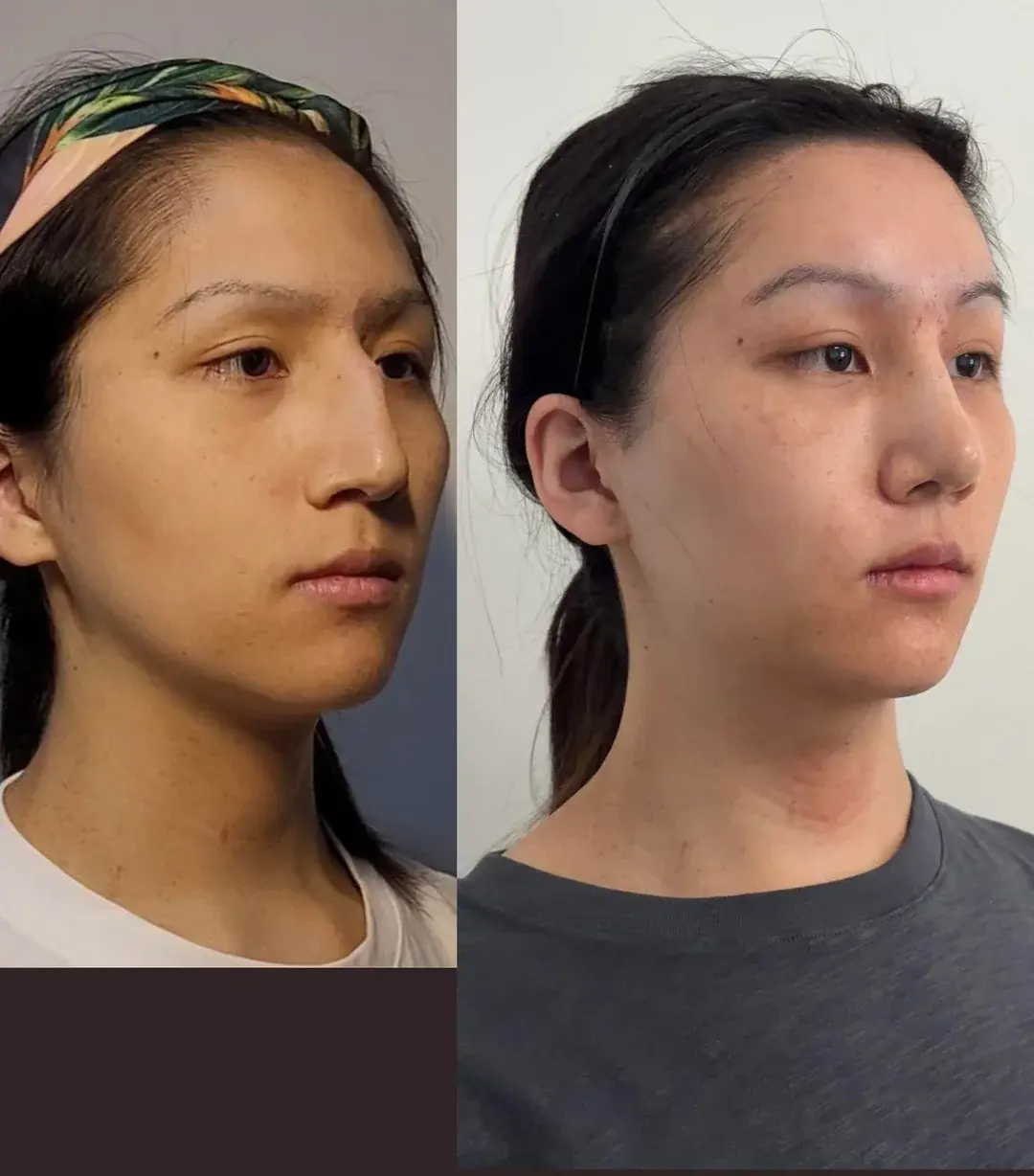 Woori Plastic Surgery Clinic — 1