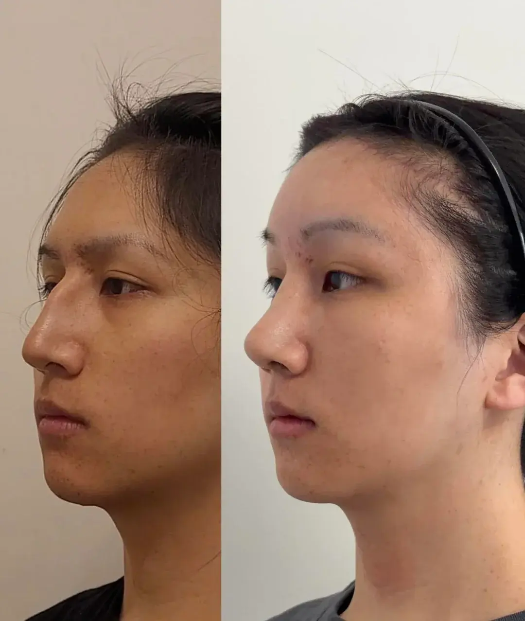 Woori Plastic Surgery Clinic — 2