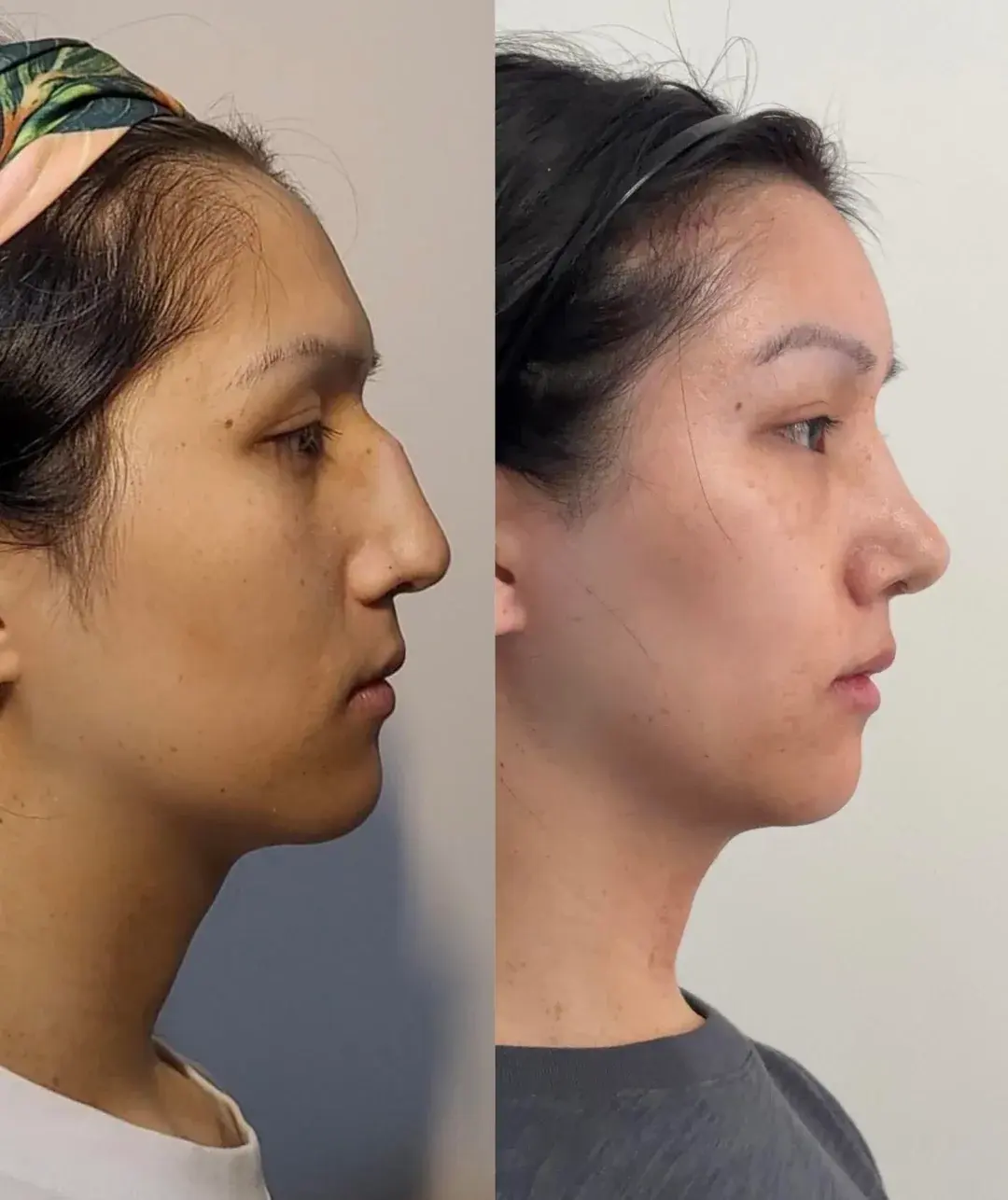 Woori Plastic Surgery Clinic — 3