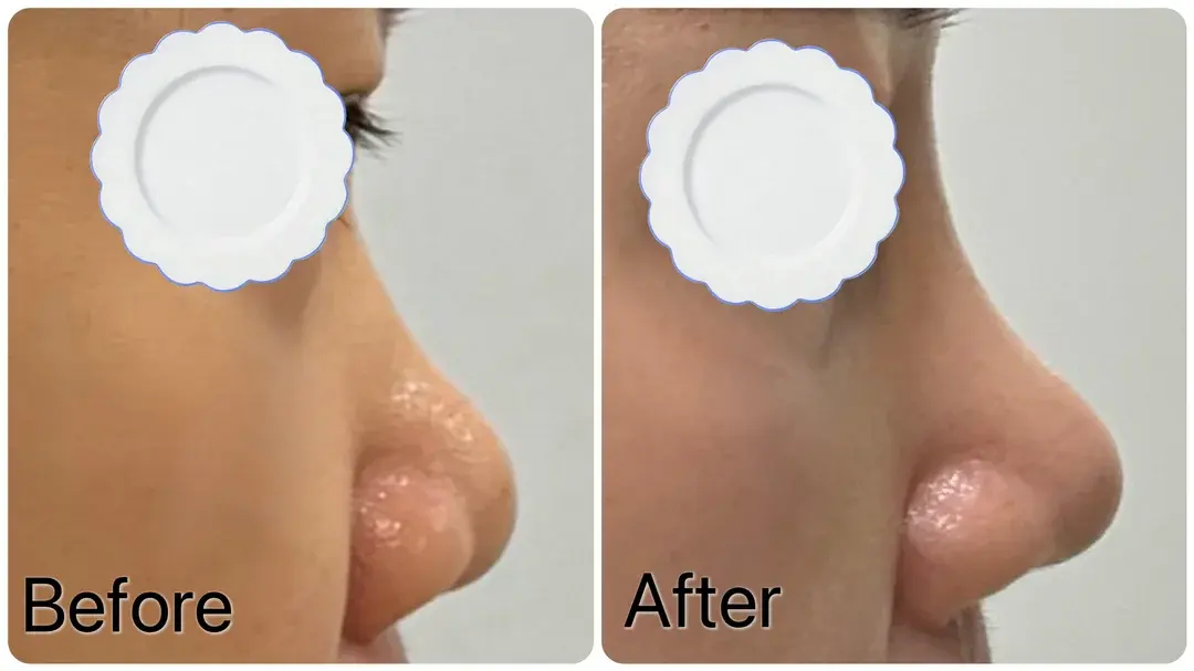 BT Plastic Surgery — 1