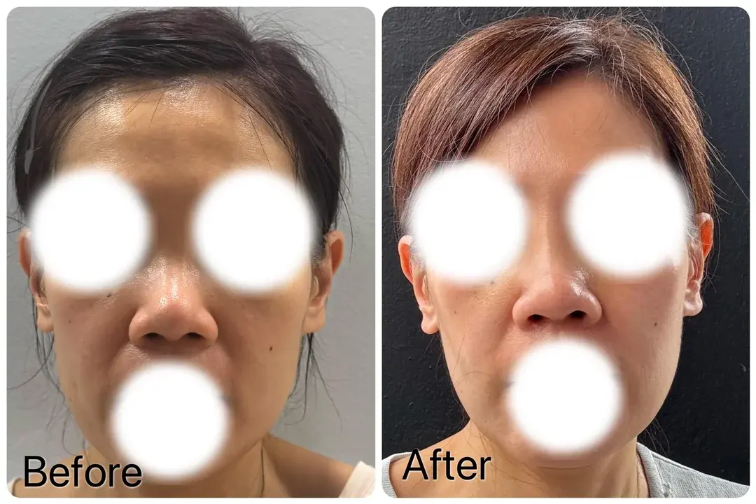 BT Plastic Surgery — 2