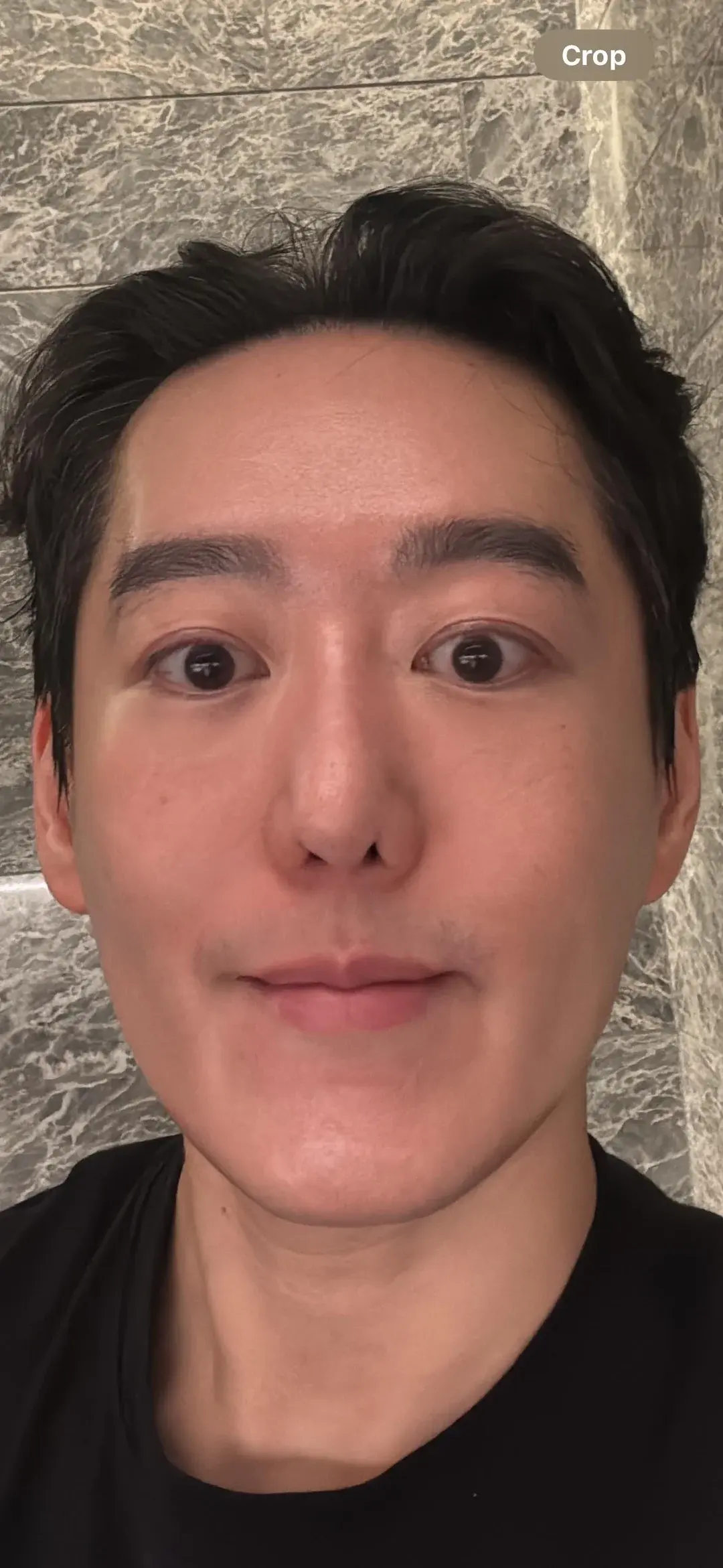 IKNOWU Plastic Surgery — 3