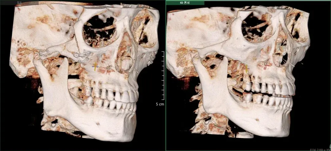 IKNOWU Plastic Surgery — 5