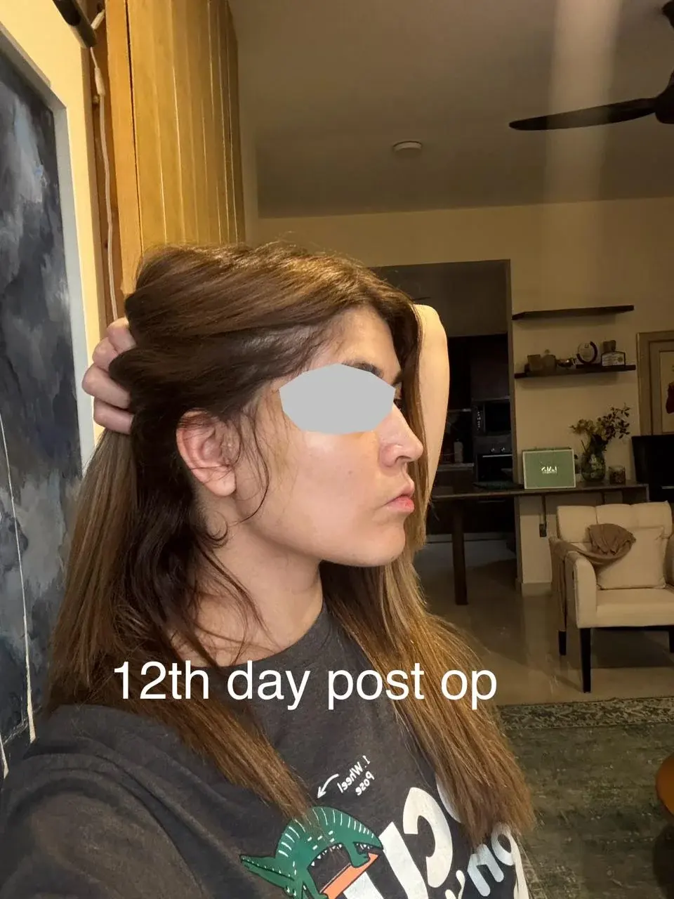 DA Plastic Surgery — 6