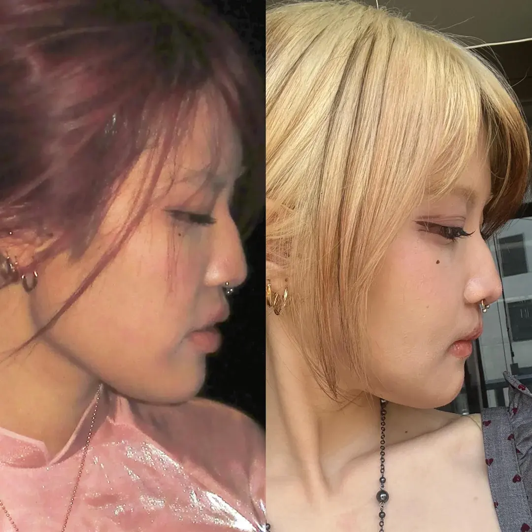 ARC Plastic Surgery — 3
