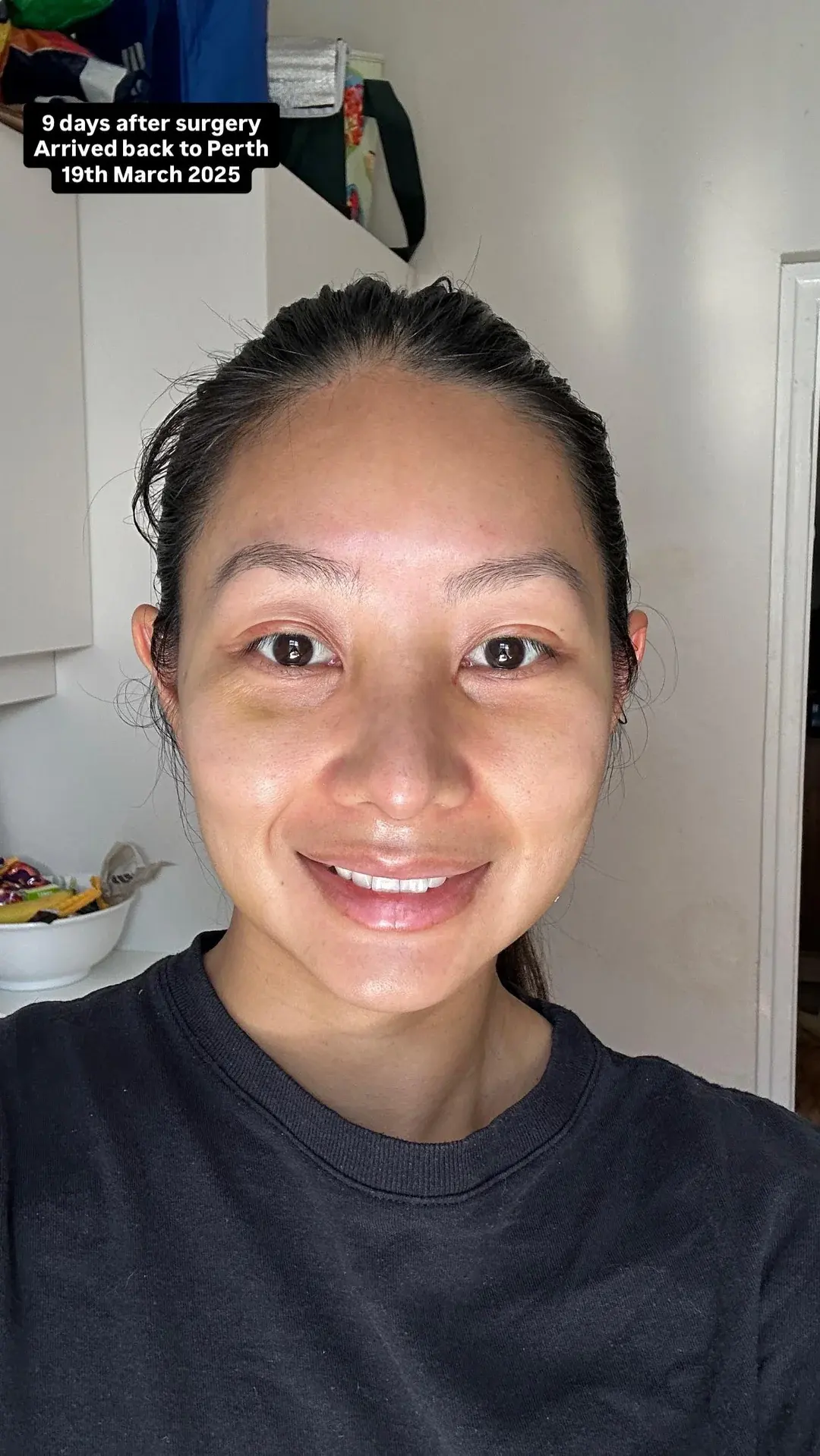 NANA Plastic Surgery — 10