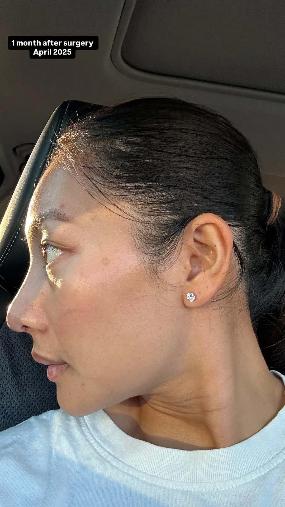 NANA Plastic Surgery — 11
