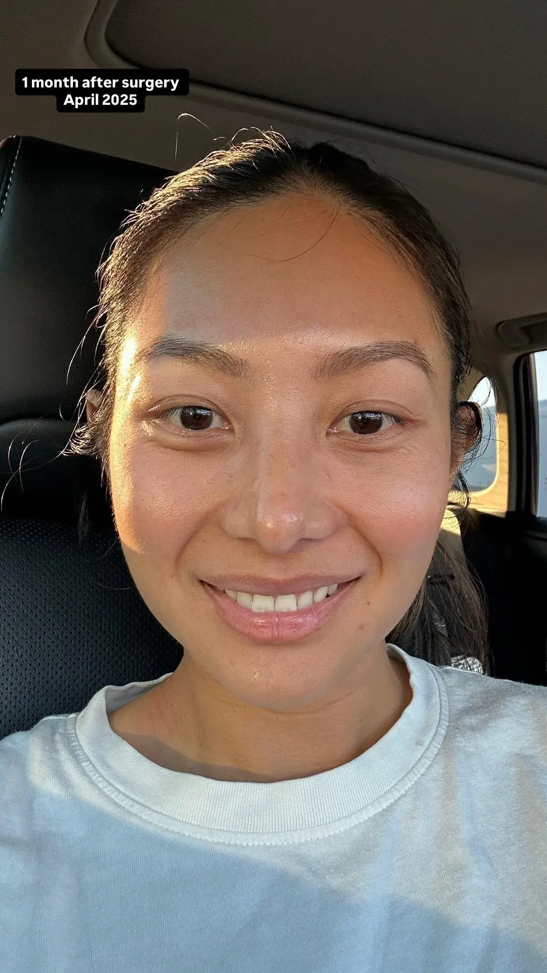 NANA Plastic Surgery — 12