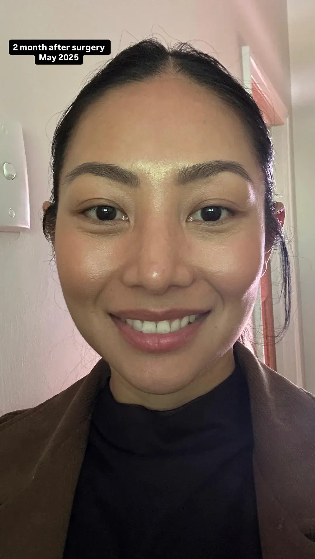 NANA Plastic Surgery — 13