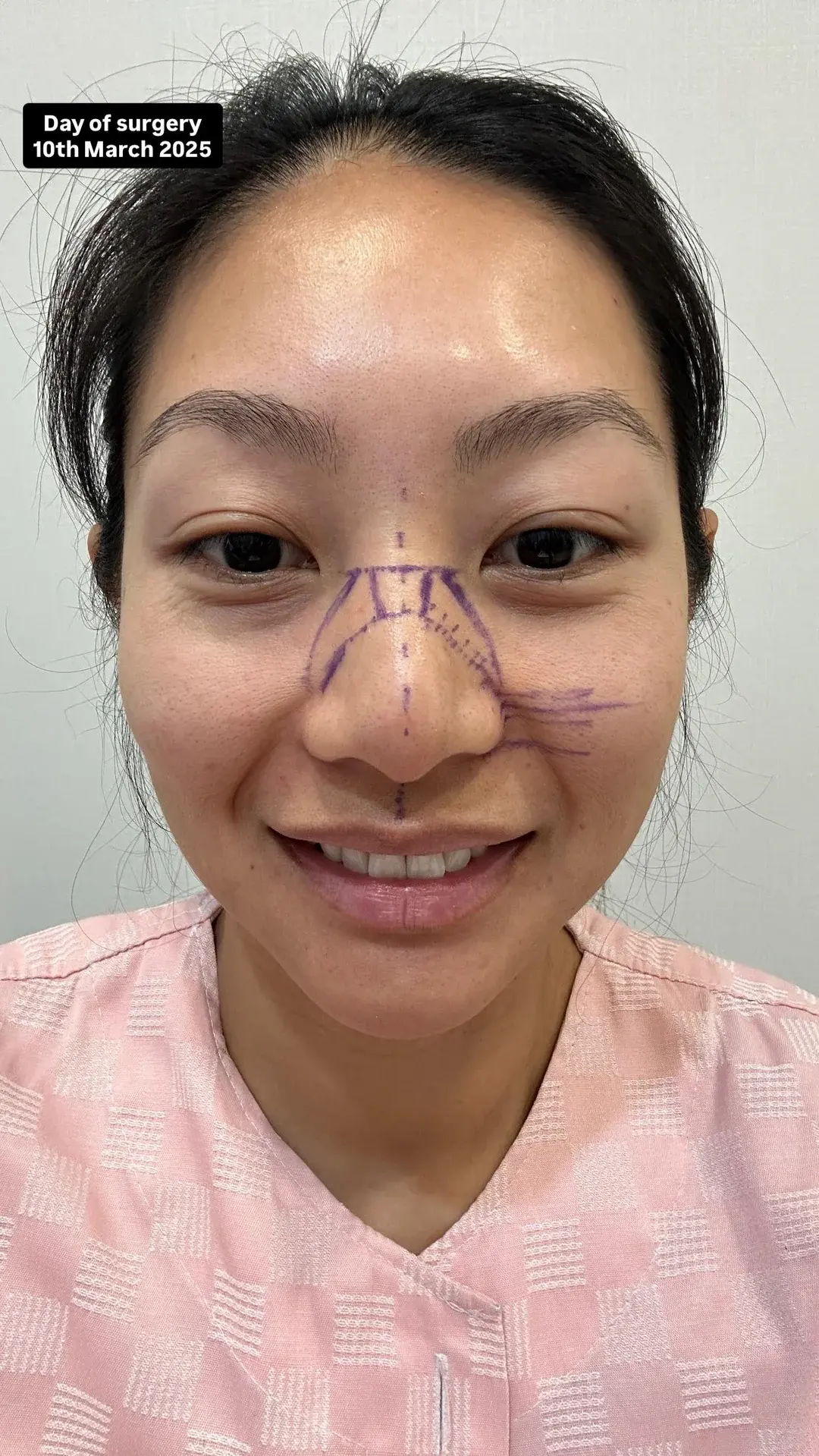 NANA Plastic Surgery — 2