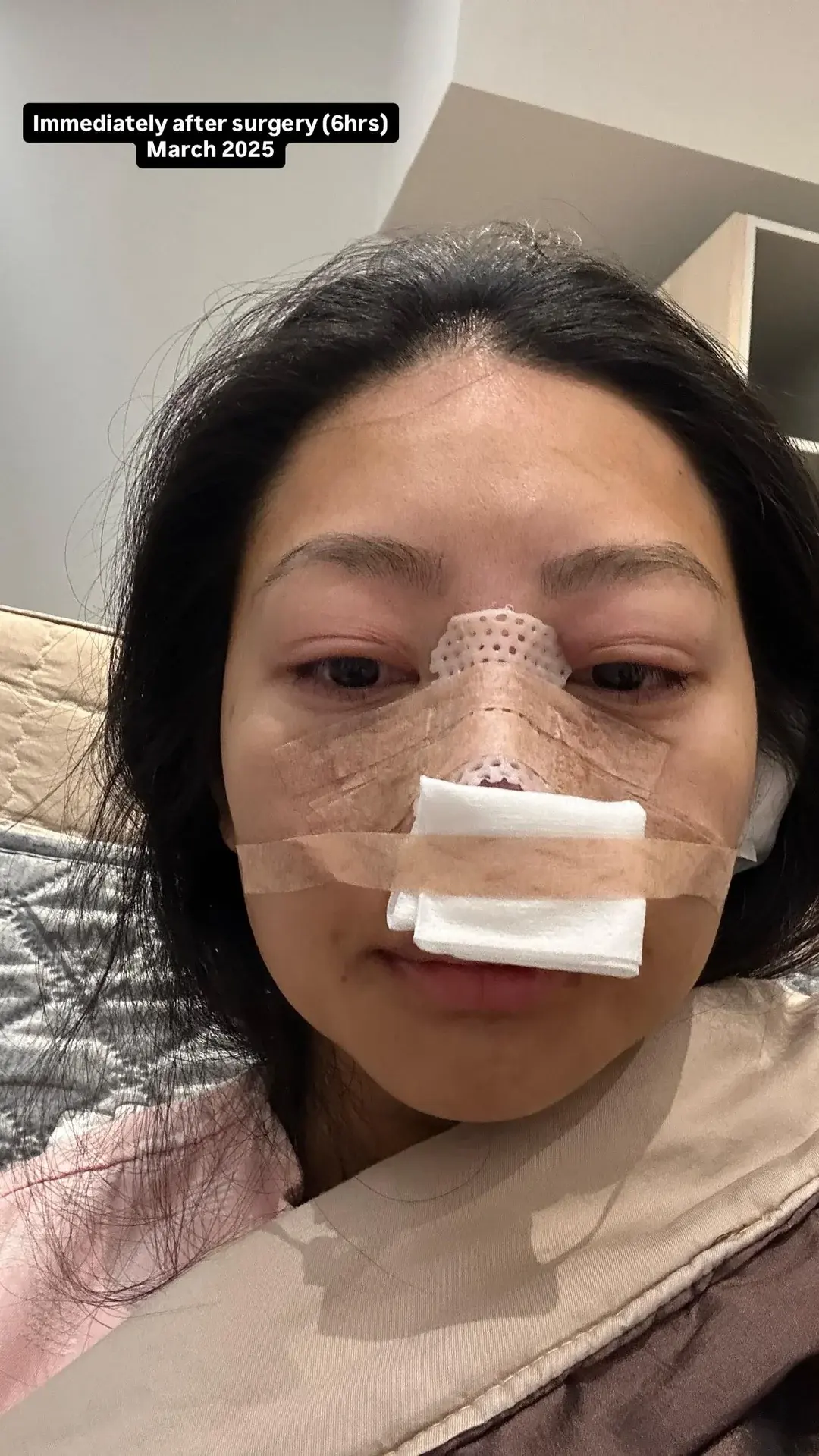 NANA Plastic Surgery — 3