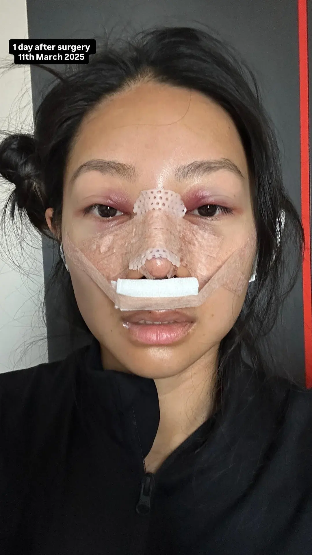 NANA Plastic Surgery — 4