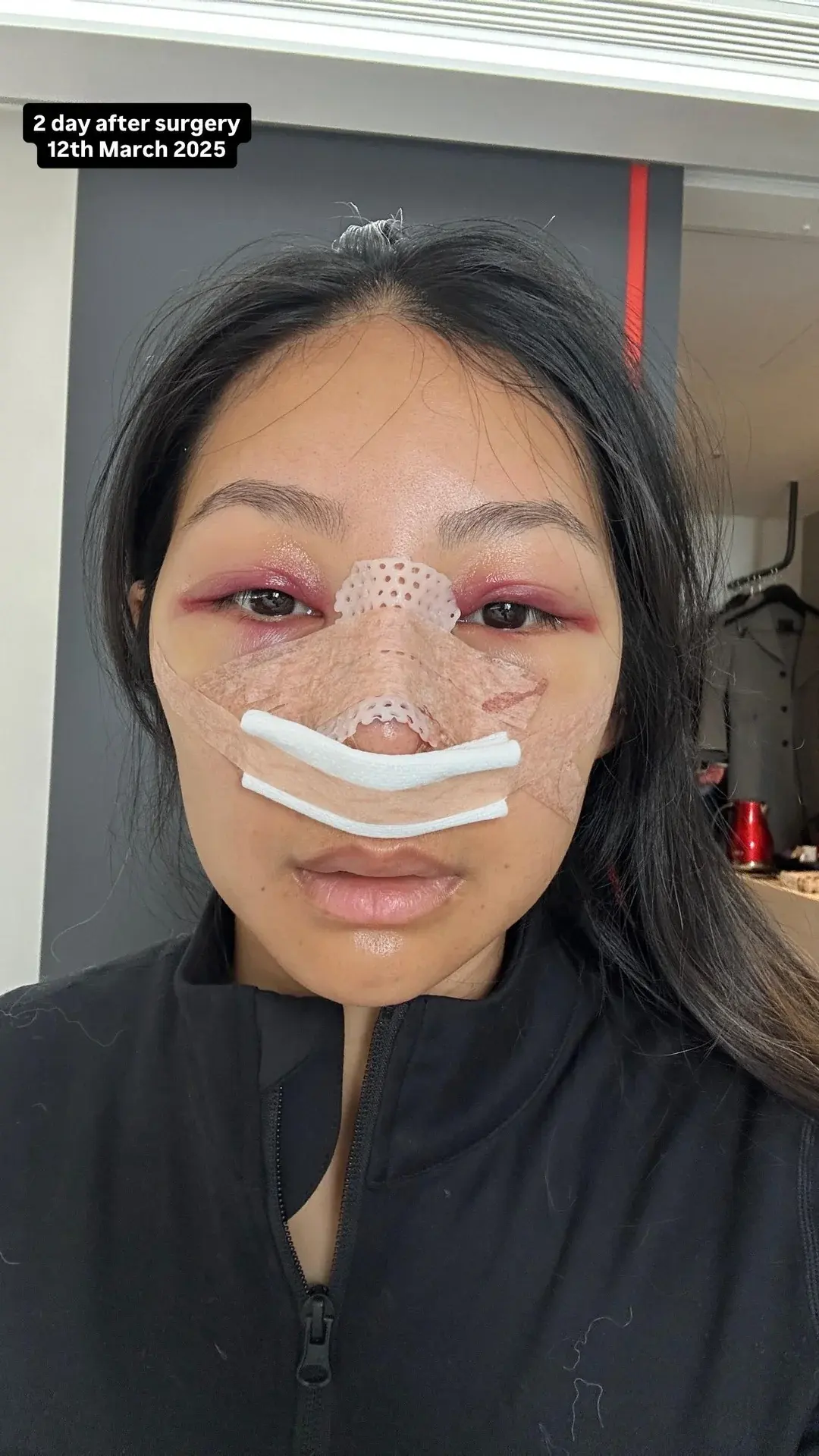 NANA Plastic Surgery — 5