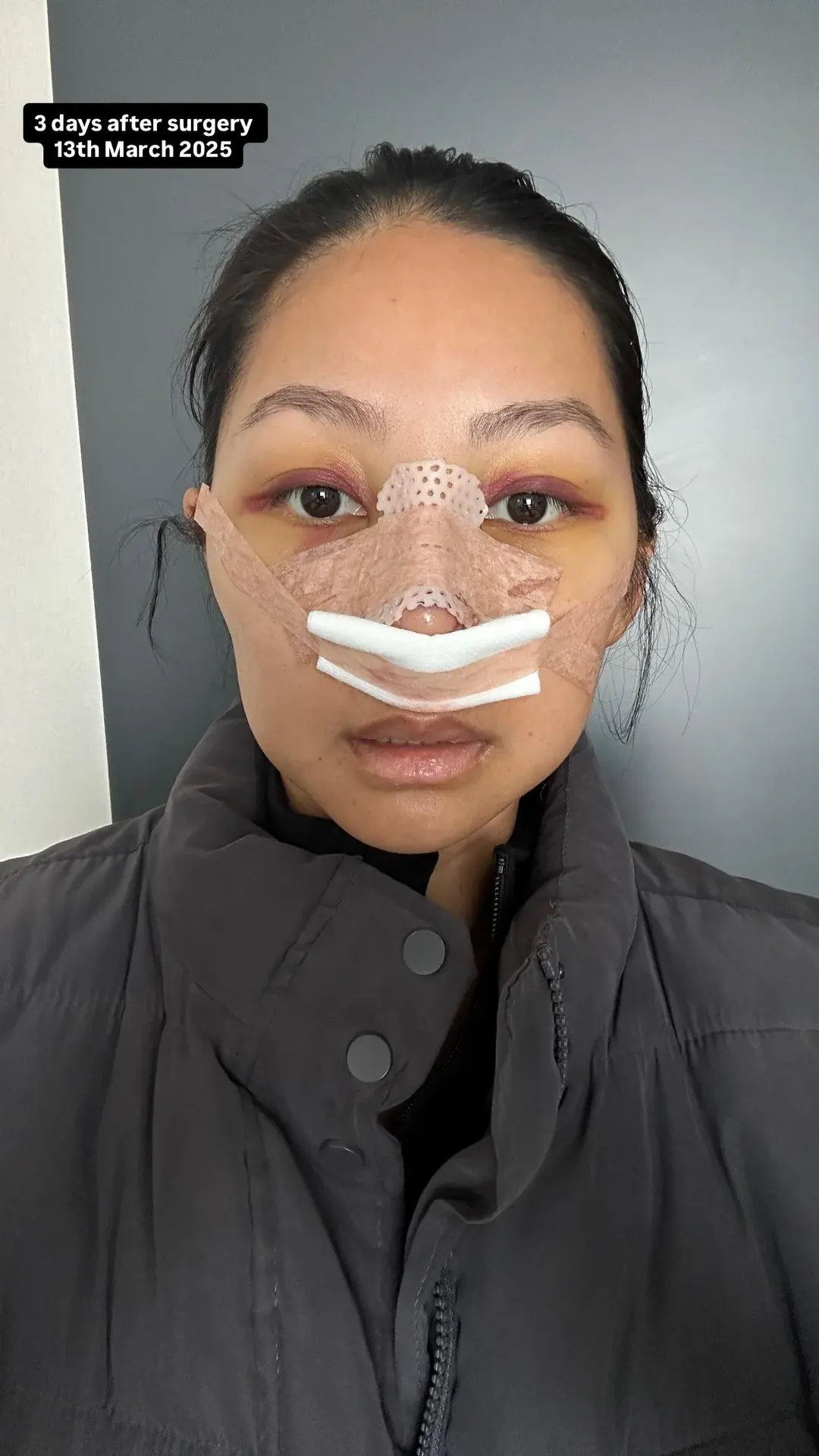 NANA Plastic Surgery — 6