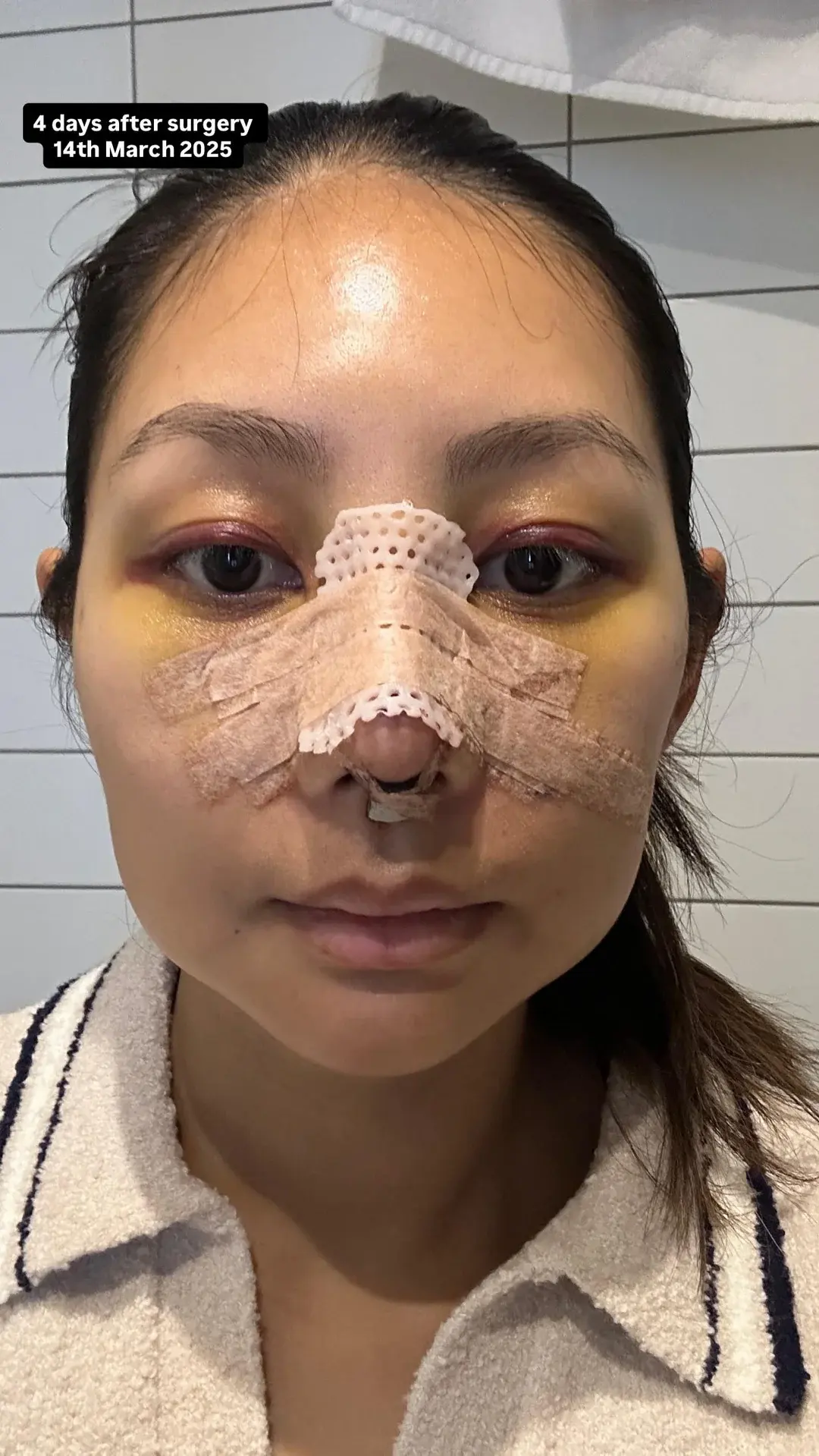 NANA Plastic Surgery — 7