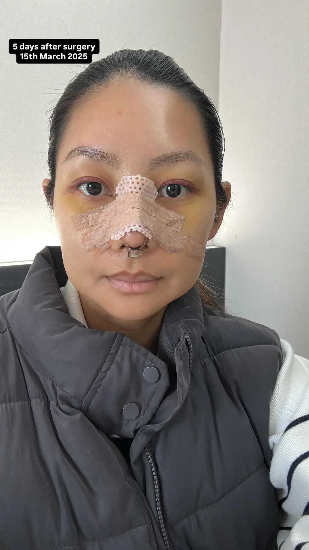 NANA Plastic Surgery — 8