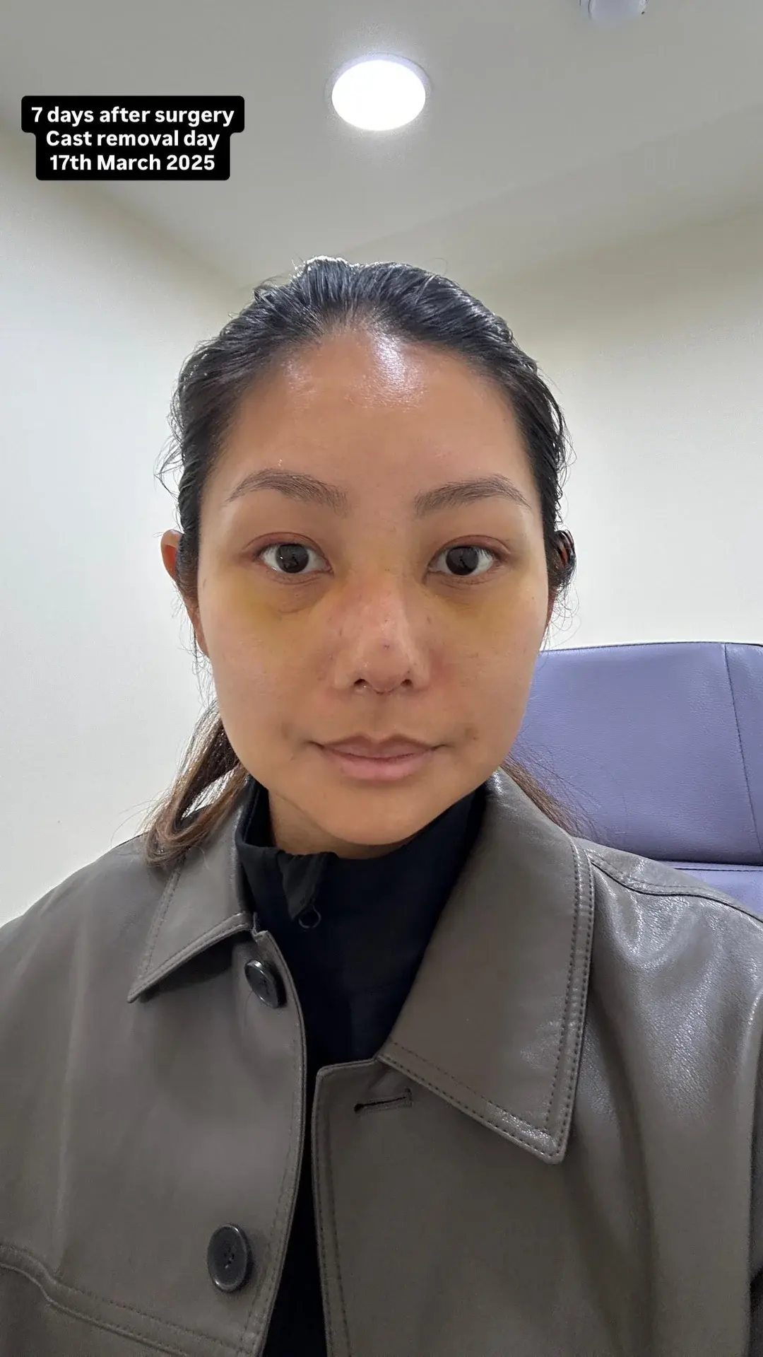 NANA Plastic Surgery — 9