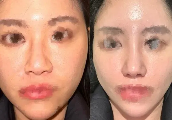 SUGAR Plastic Surgery — 1