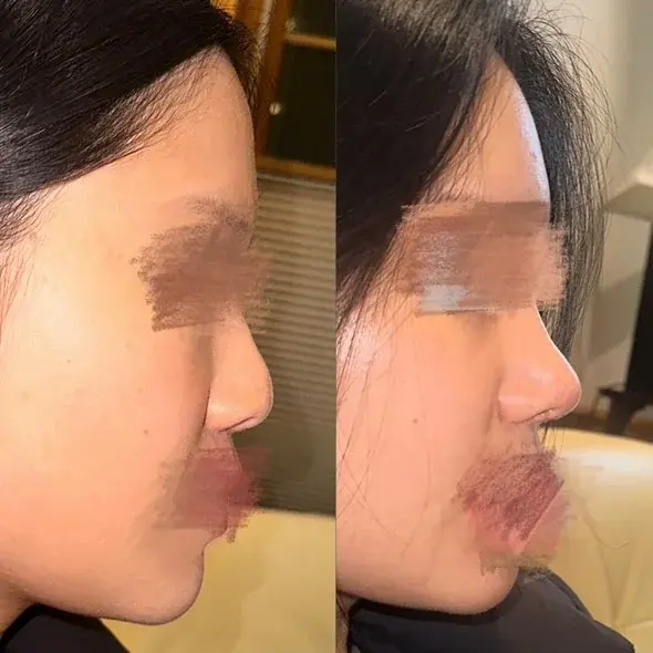 SUGAR Plastic Surgery — 2