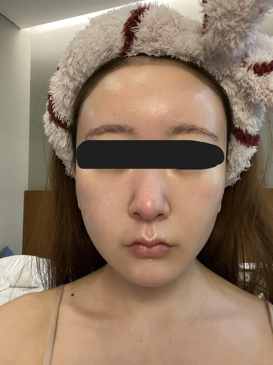 Retmus Plastic Surgery — 1