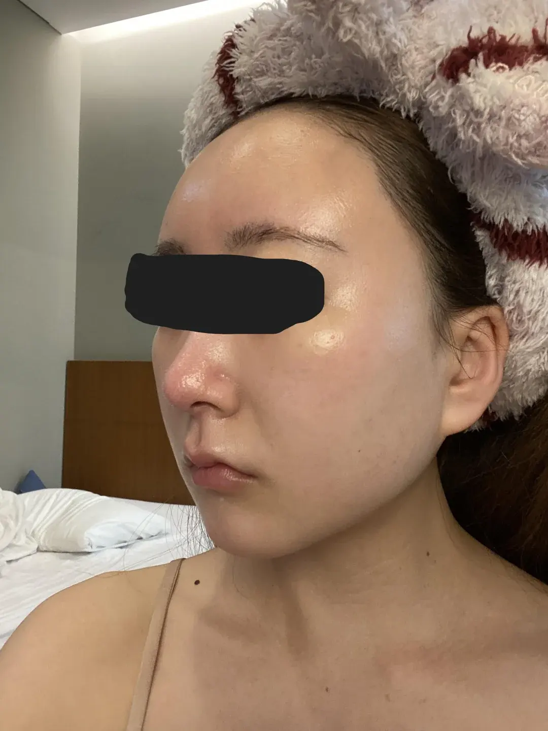 Retmus Plastic Surgery — 2