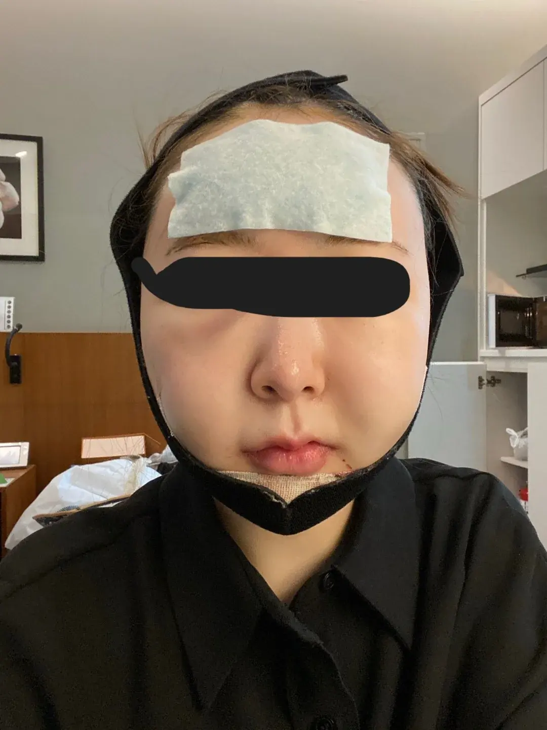 Retmus Plastic Surgery — 3