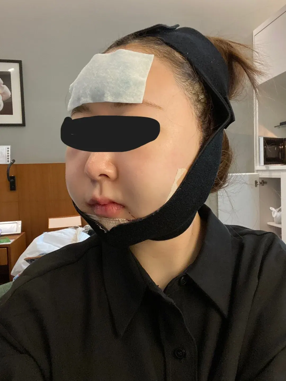 Retmus Plastic Surgery — 4
