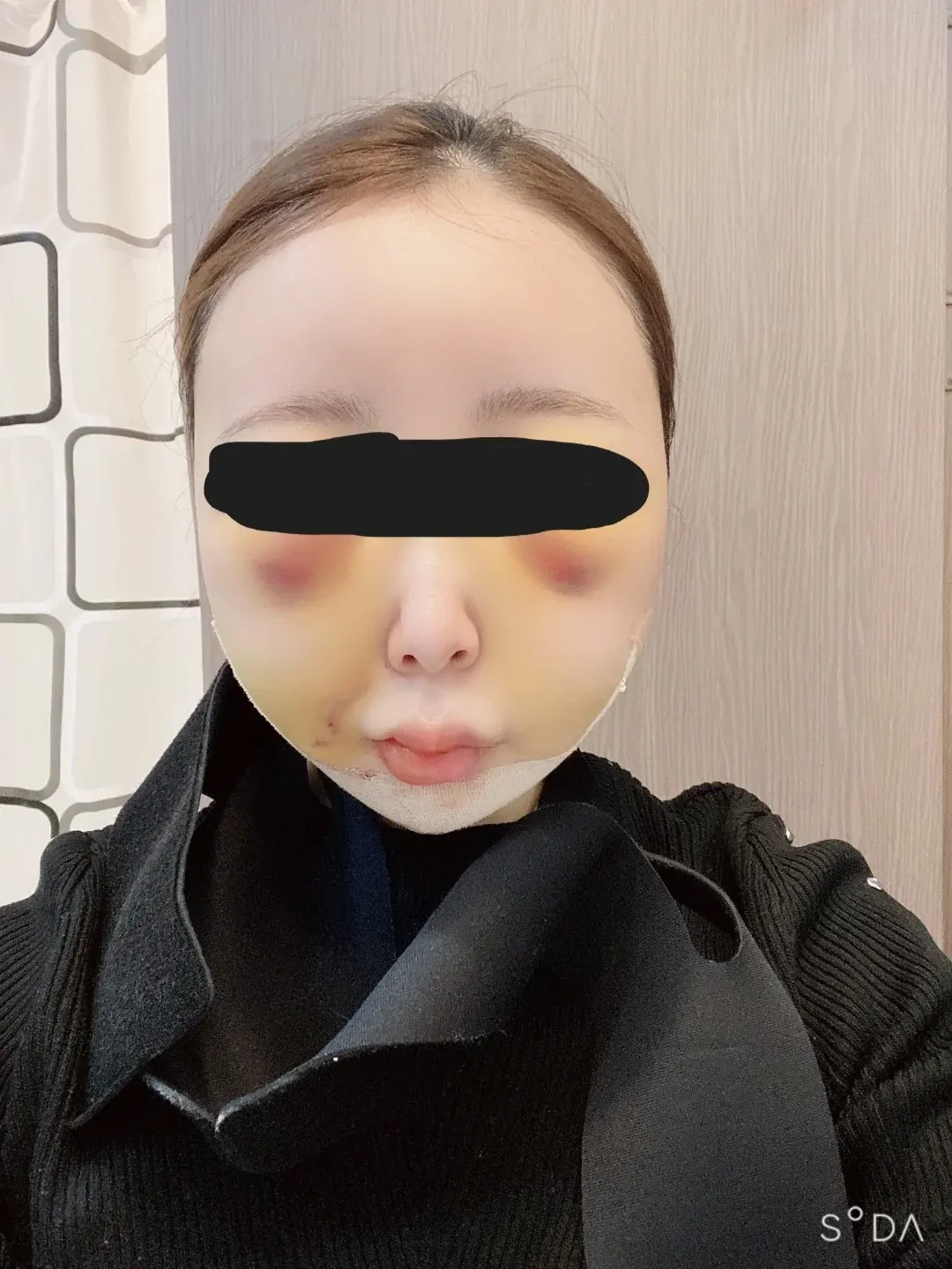 Retmus Plastic Surgery — 5