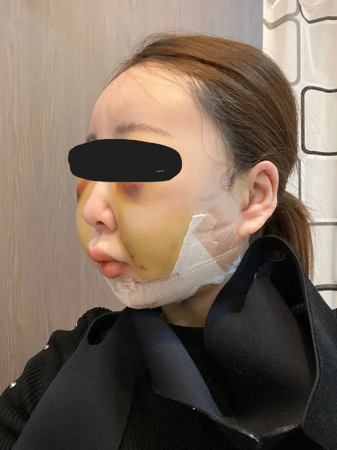 Retmus Plastic Surgery — 6