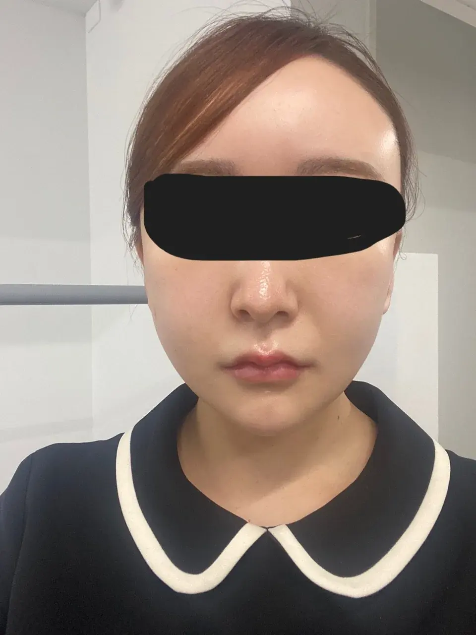 Retmus Plastic Surgery — 7