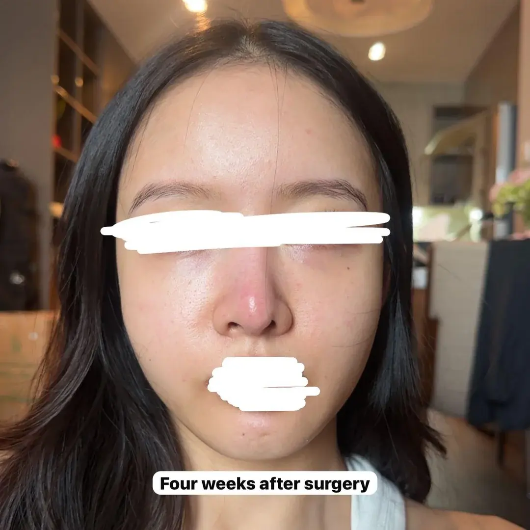 Woori Plastic Surgery Clinic — 4