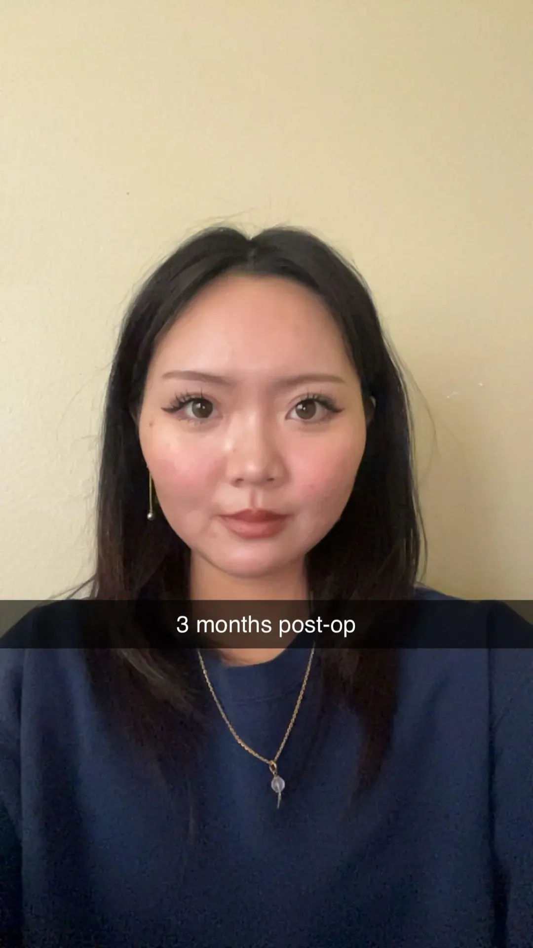 DA Plastic Surgery — 10
