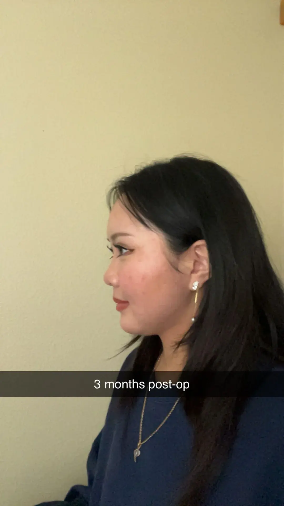 DA Plastic Surgery — 8
