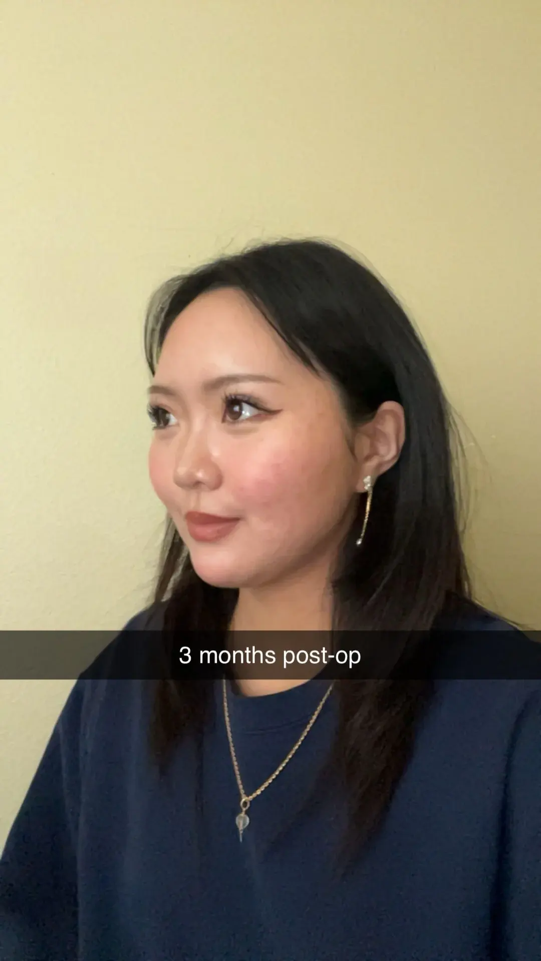 DA Plastic Surgery — 9