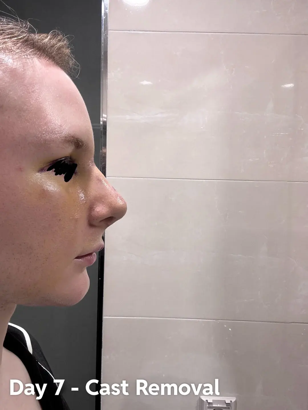 AB Plastic Surgery — 4