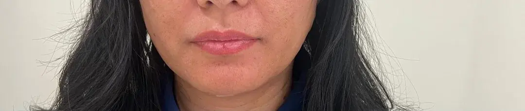 The Fitting Clinic — 4
