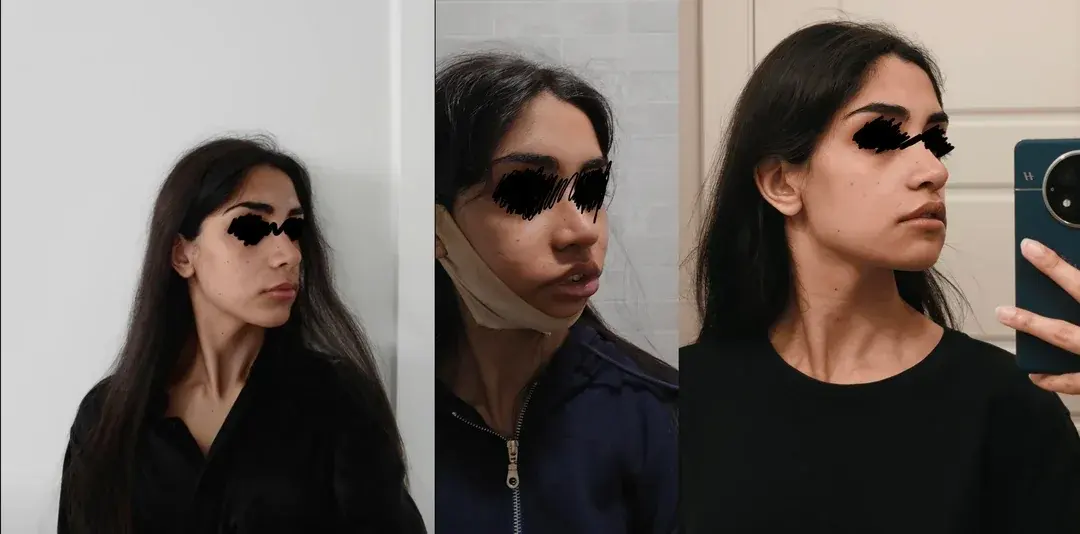 Retmus Plastic Surgery — 2