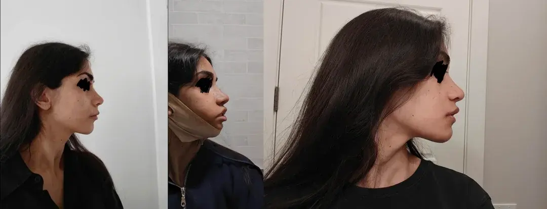 Retmus Plastic Surgery — 3