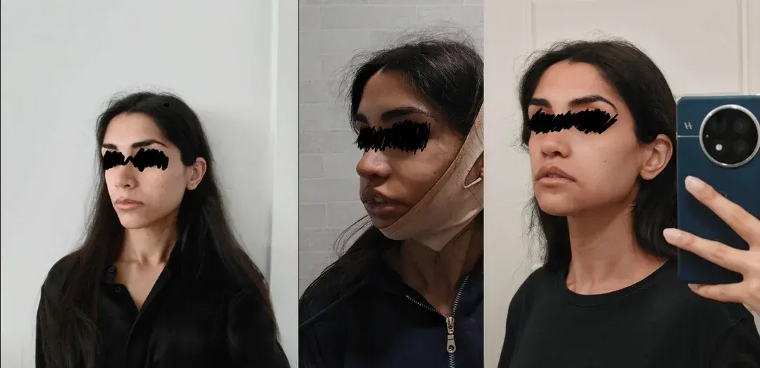 Retmus Plastic Surgery — 4