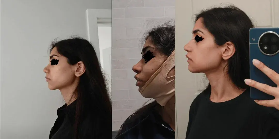 Retmus Plastic Surgery — 5
