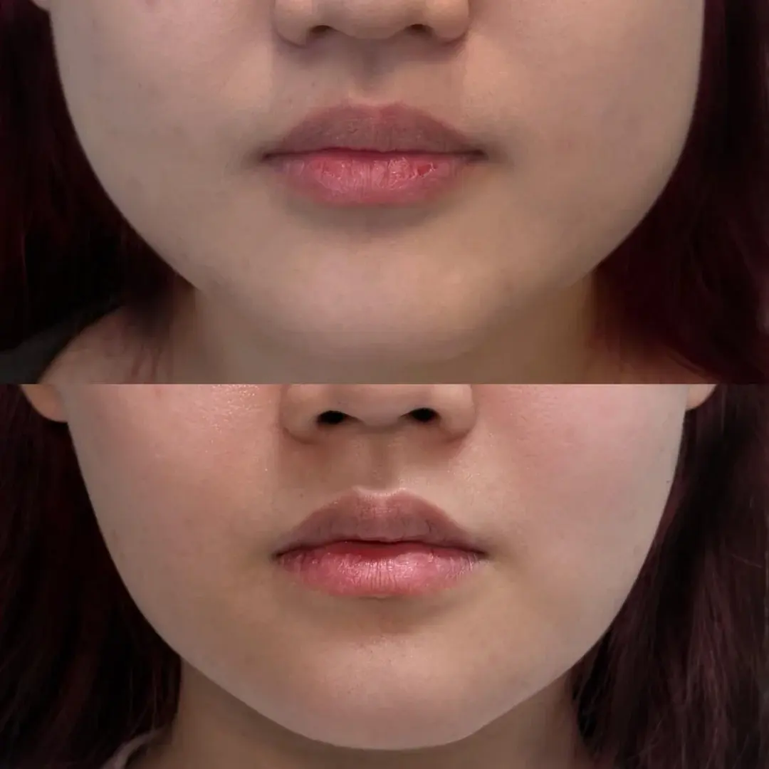 345 Plastic Surgery — 1