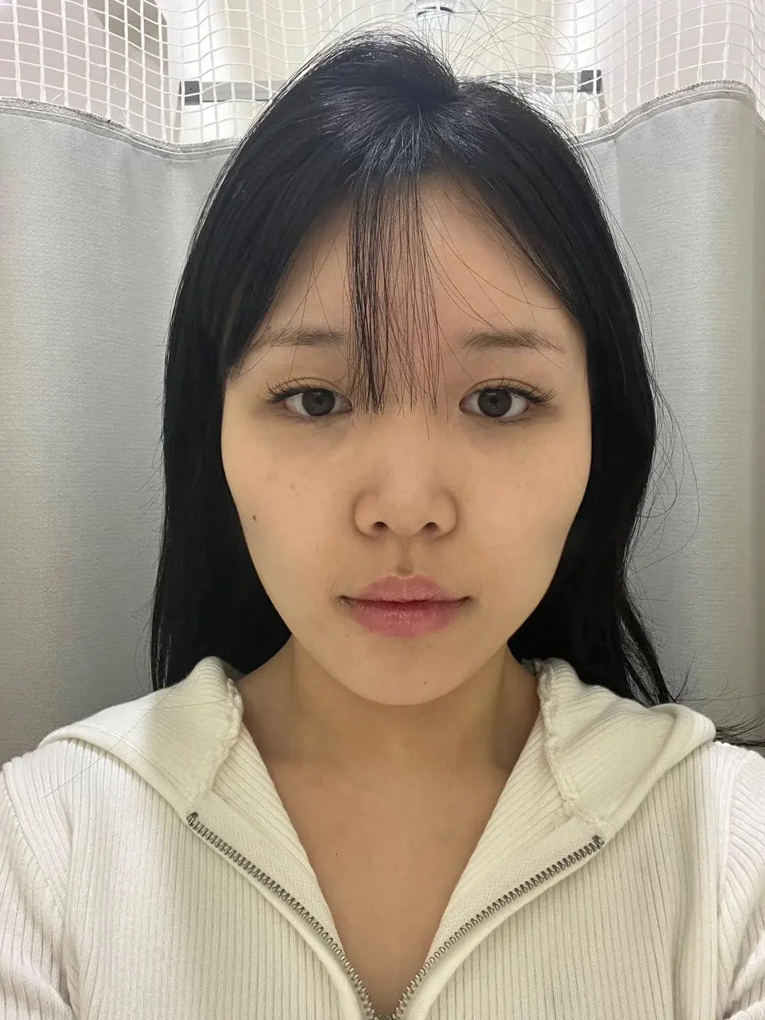 Woori Plastic Surgery Clinic — 1