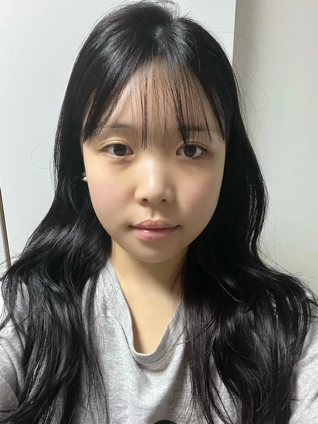 Woori Plastic Surgery Clinic — 2
