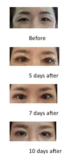 LUHO Plastic Surgery — 1