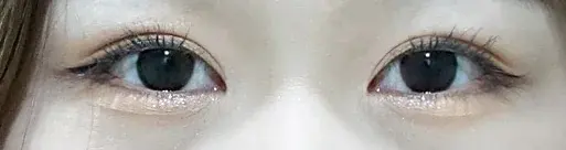 Wink Plastic Surgery — 2