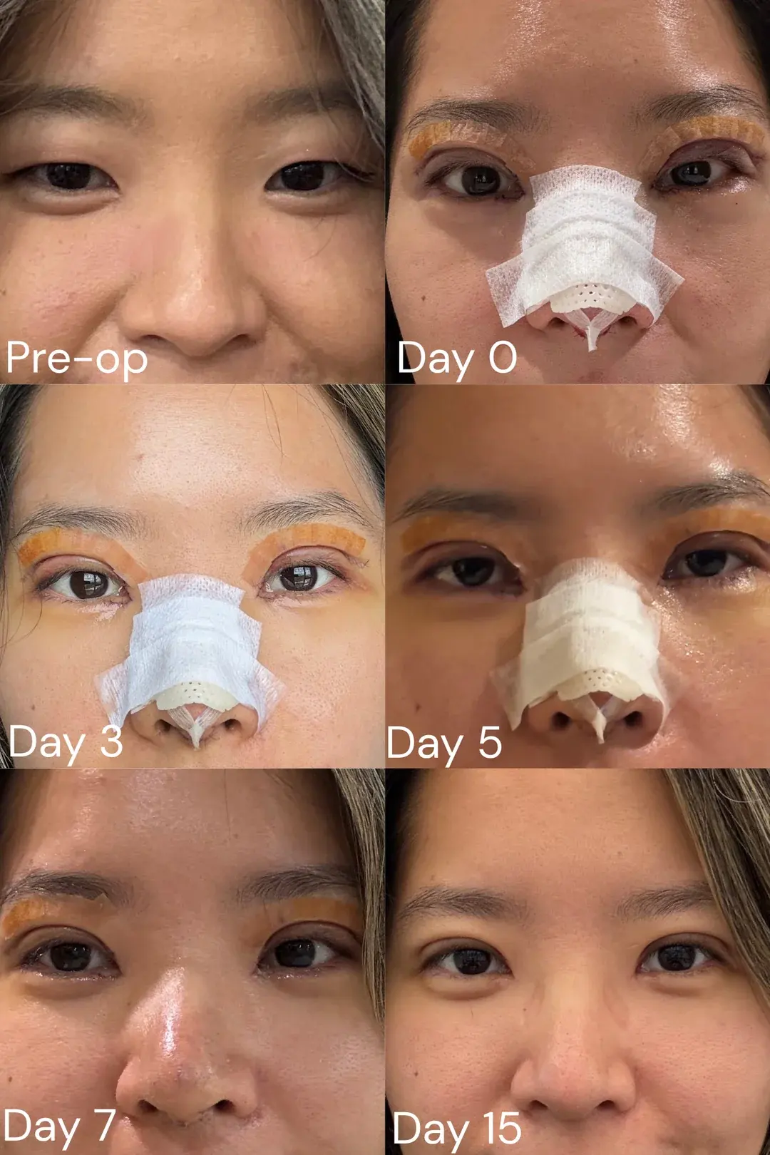 JW Plastic Surgery — 1