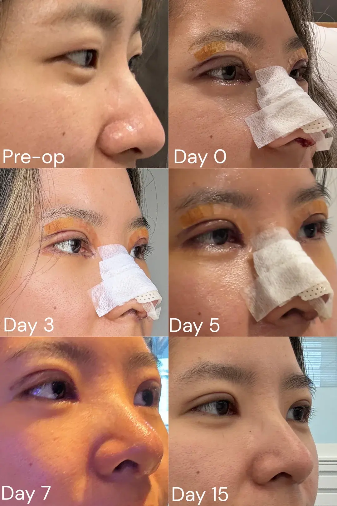 JW Plastic Surgery — 2