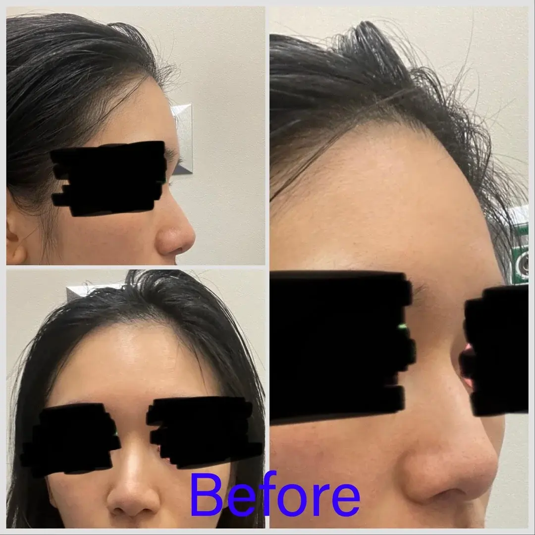 Begin Plastic Surgery — 1