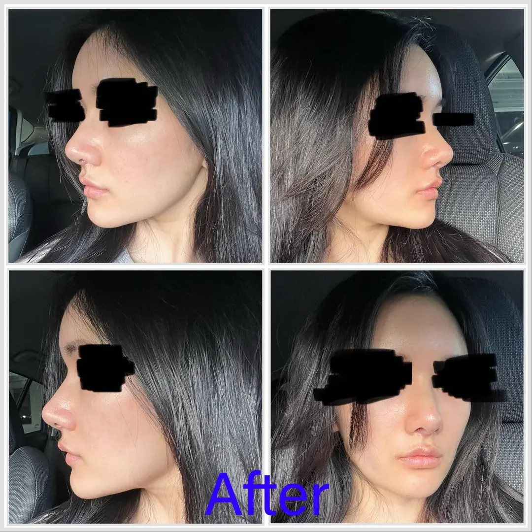 Begin Plastic Surgery — 2
